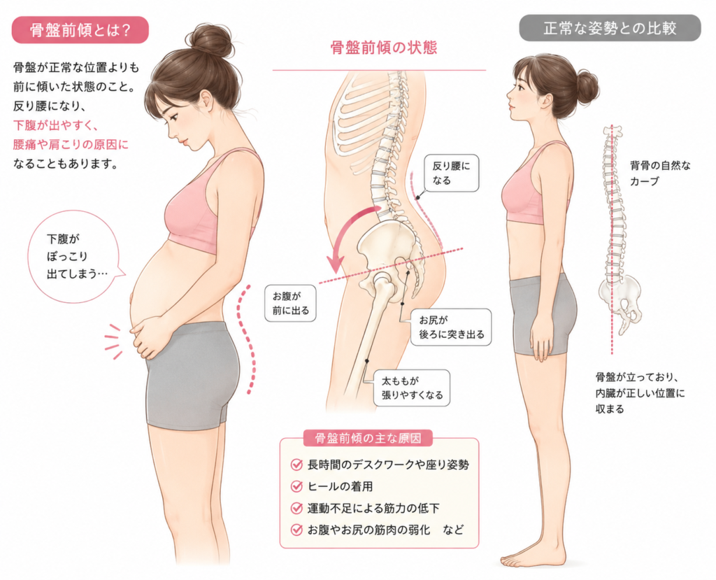 女性のポッコリお腹の原因|骨盤・姿勢との関係
